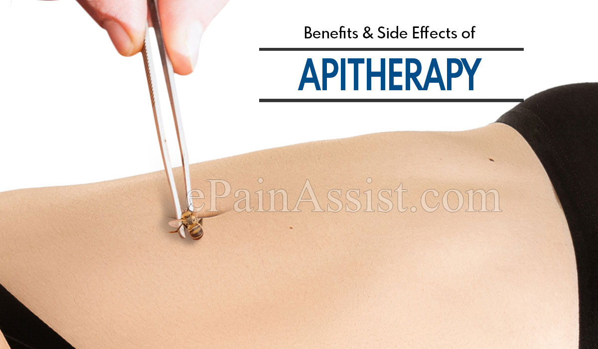 Benefits and Side Effects of Apitherapy