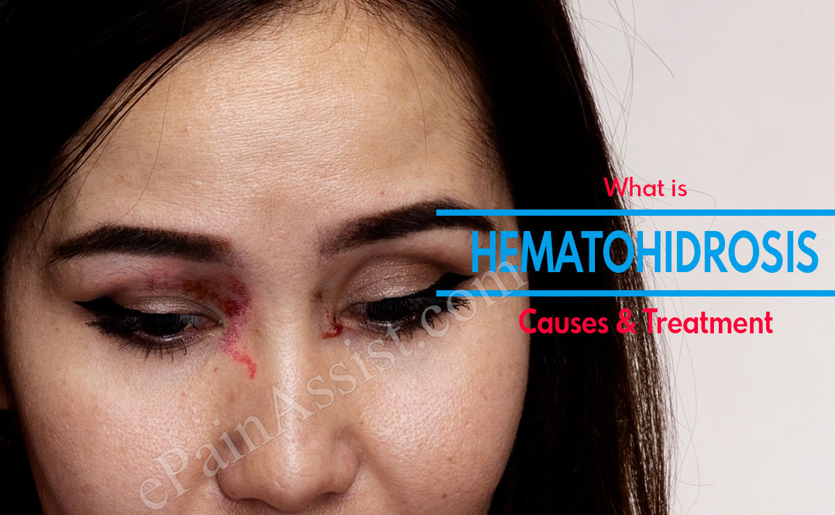 Hematohidrosis: Causes and Treatment