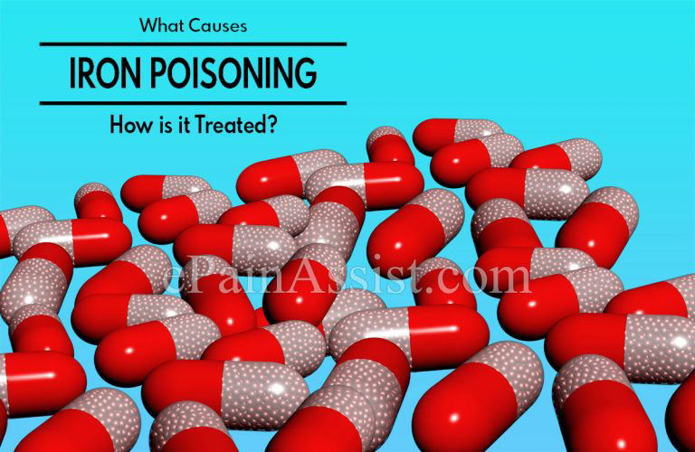 What Causes Iron Poisoning and How is it Treated?