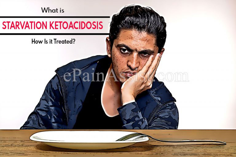 What is Starvation Ketoacidosis & How Is it Treated? | Causes, Symptoms, and Complications of Starvation Ketoacidosis