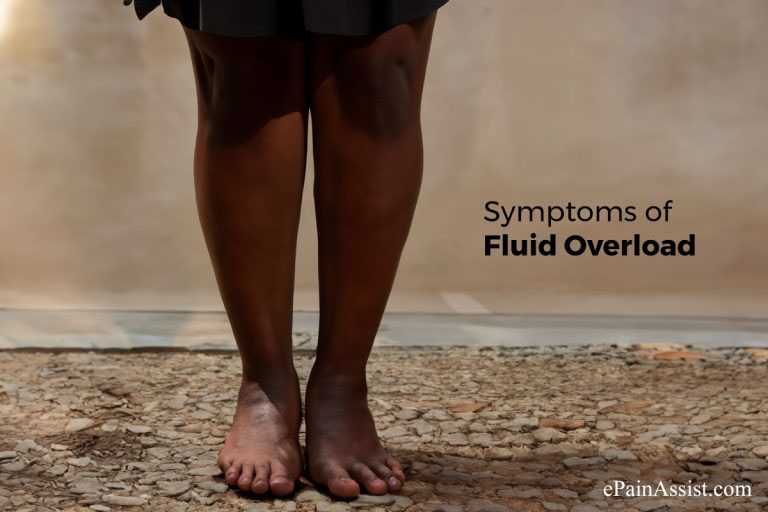 Understanding Fluid Overload in the Elderly : Causes, Symptoms, and Management