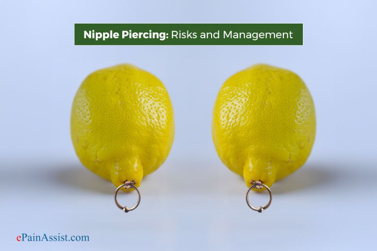 Nipple Piercing: Risks and Management