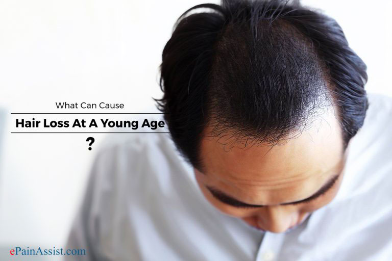 What Can Cause Hair Loss At A Young Age?