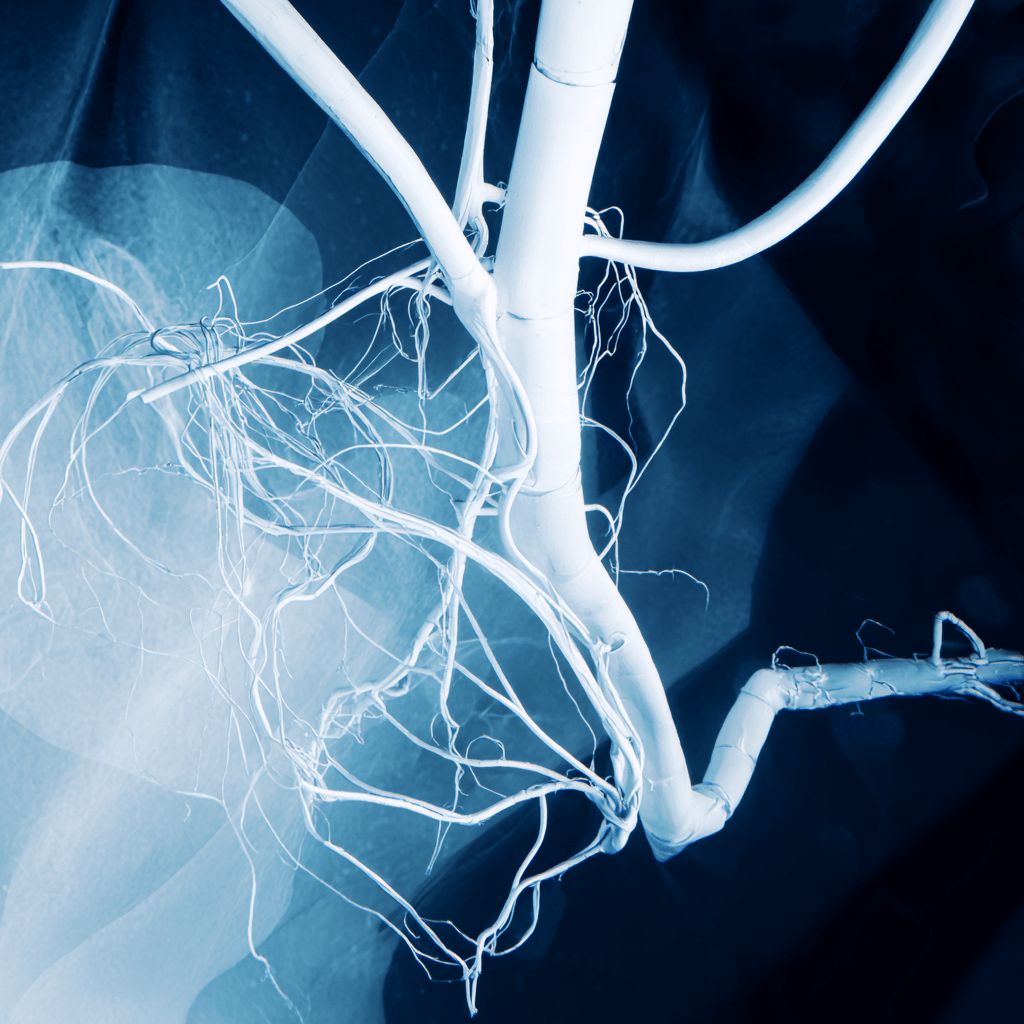 Radial vs Femoral Access in Angiograms: Key Differences