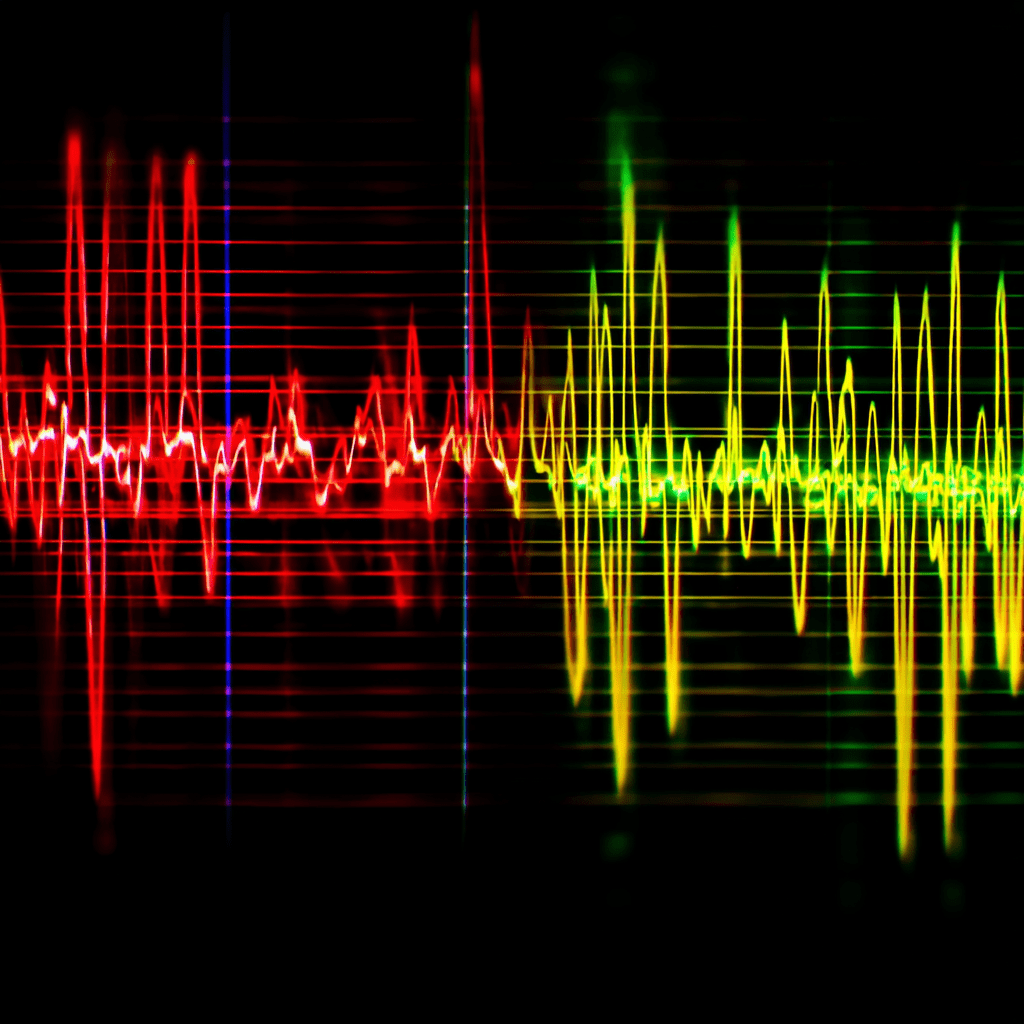 Understanding Right Axis Deviation: When to Worry
