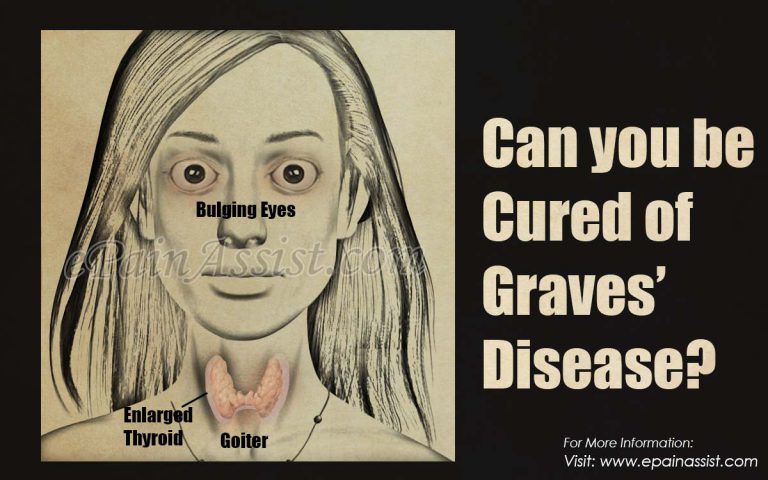 Can you be Cured of Graves’ Disease?
