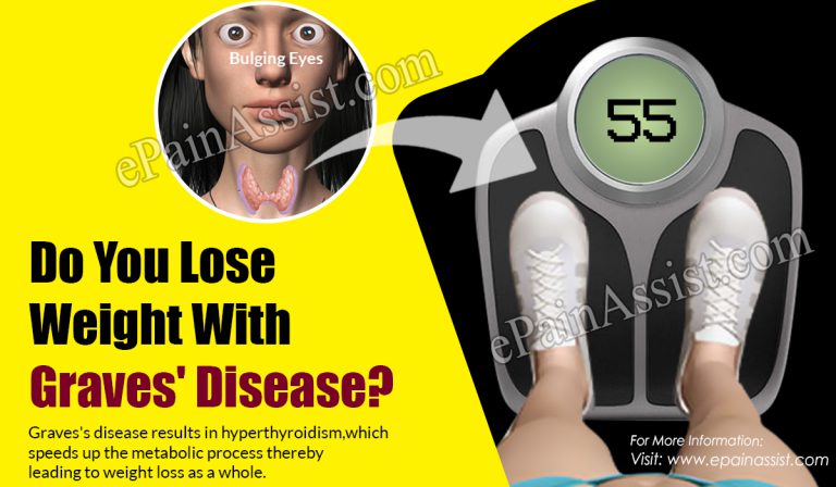 Do You Lose Weight With Graves’ Disease?