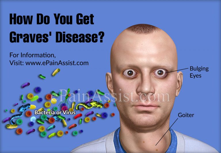 How Do You Get Graves’ Disease?