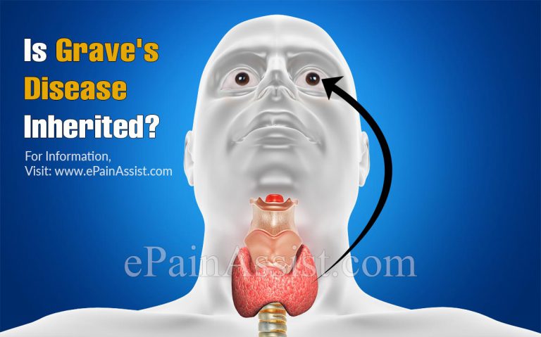 Is Grave’s disease Inherited?