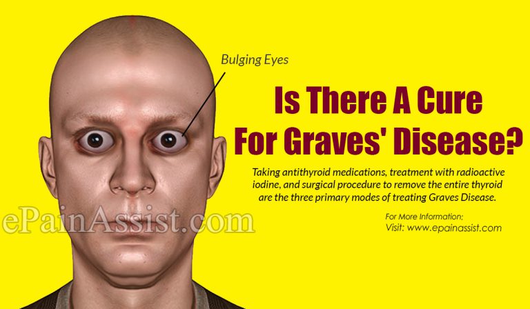 Is There A Cure For Graves’ Disease?