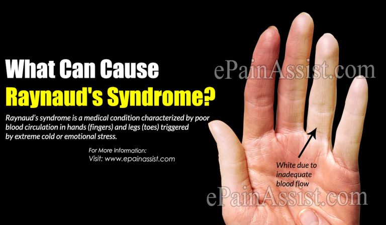 What Can Cause Raynaud’s Syndrome?