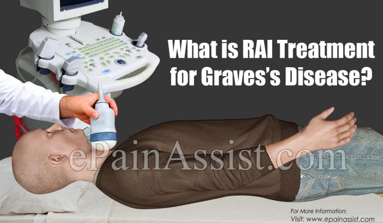 What is RAI Treatment for Graves’s Disease?