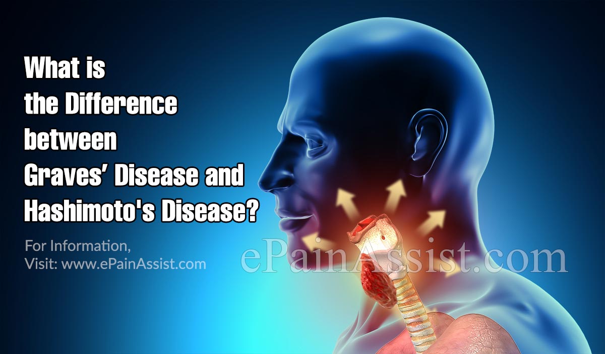 What Is The Difference Between Graves’ Disease And Hashimoto's Disease?