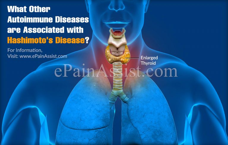 What Other Autoimmune Diseases Are Associated With Hashimoto’s Disease?