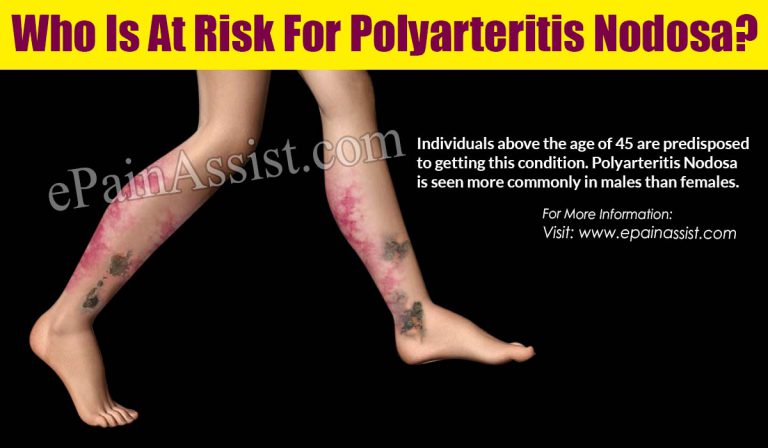 Who Is At Risk For Polyarteritis Nodosa?
