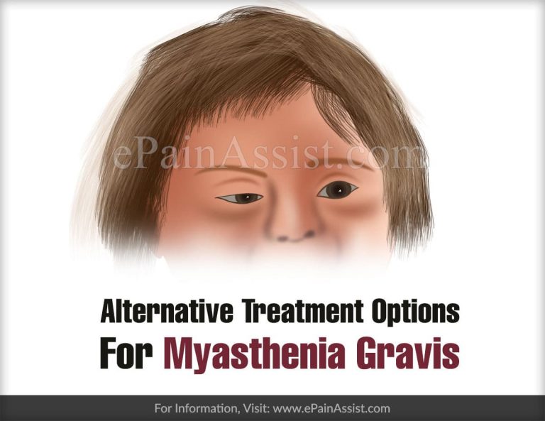 Alternative Treatment Options For Myasthenia Gravis