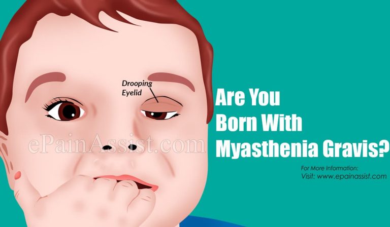 Are You Born With Myasthenia Gravis?