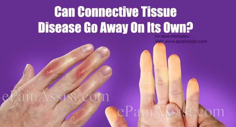 Can Connective Tissue Disease Go Away On Its Own?