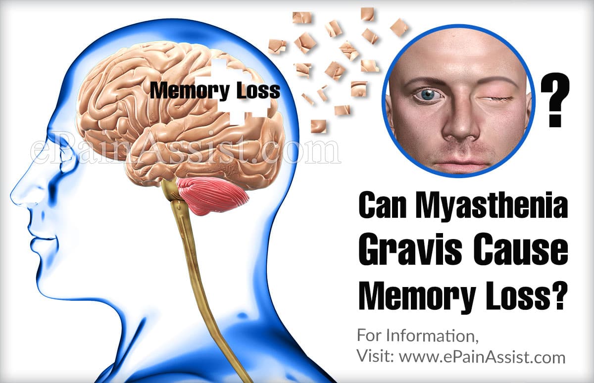 Can Myasthenia Gravis Cause Memory Loss?