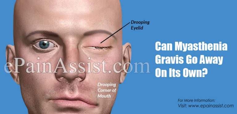 Can Myasthenia Gravis Go Away On Its Own?