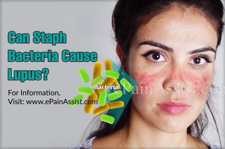 Can Staph Bacteria Cause Lupus?