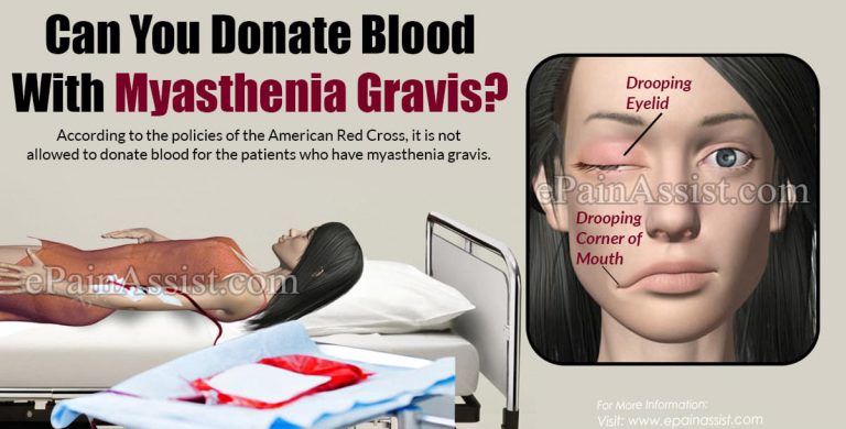 Can You Donate Blood With Myasthenia Gravis?