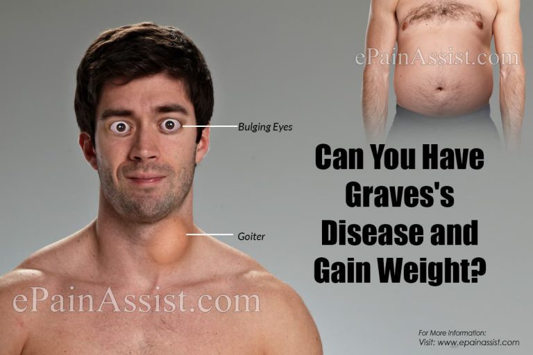 Can You Have Graves’s Disease and Gain Weight?