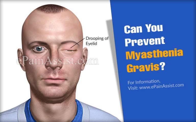 Can You Prevent Myasthenia Gravis?