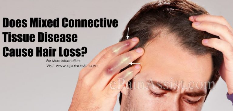 Can Mixed Connective Tissue Disease Be Reversed?