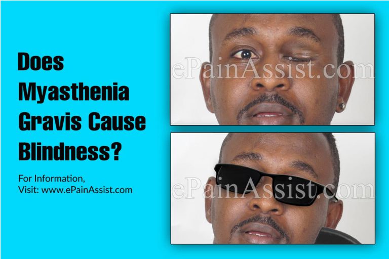 Does Myasthenia Gravis Cause Blindness?