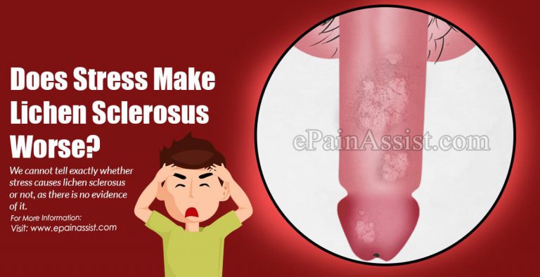 Does Stress Make Lichen Sclerosus Worse?