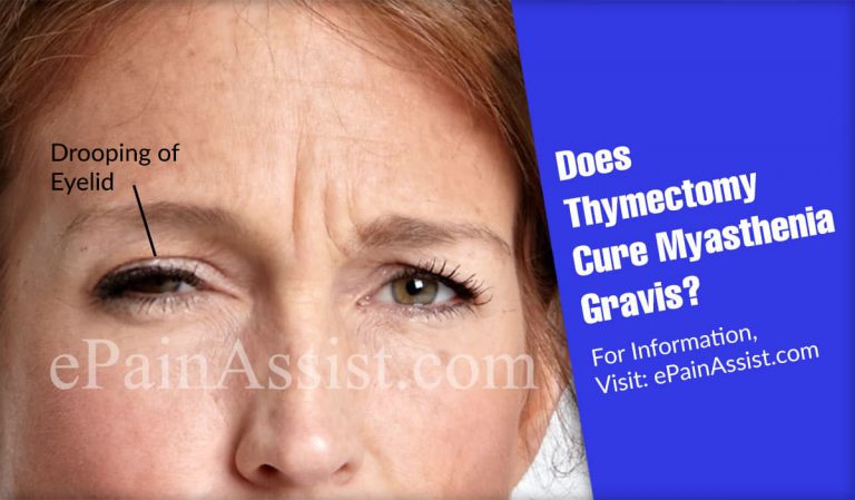 Does Thymectomy Cure Myasthenia Gravis?