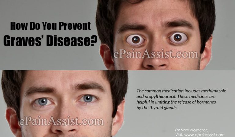 How Do You Prevent Graves’ Disease?