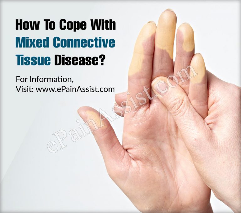 How To Cope With Mixed Connective Tissue Disease?