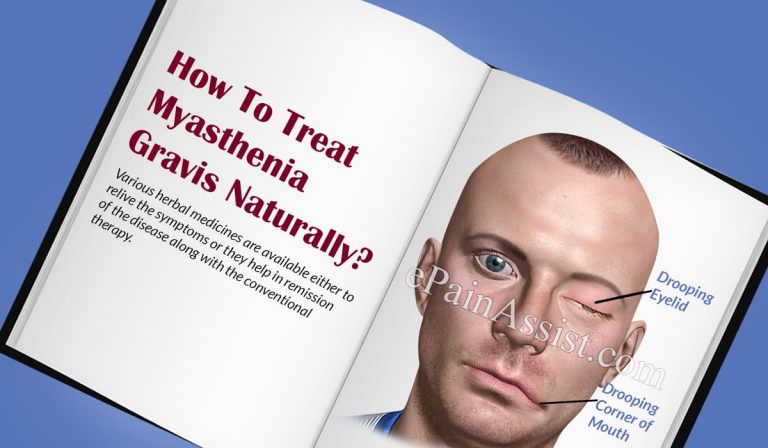 How To Treat Myasthenia Gravis Naturally?