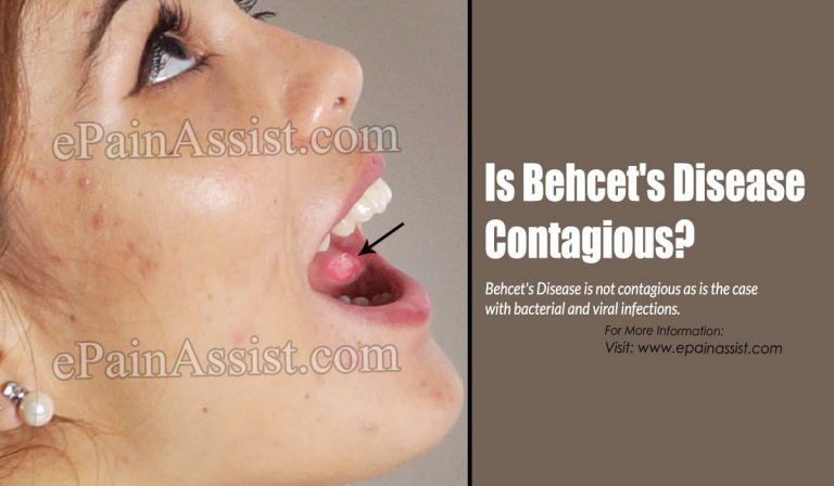 Is Behcet’s Disease Contagious?