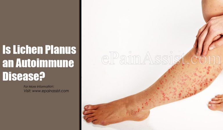 Is Lichen Planus an Autoimmune Disease?