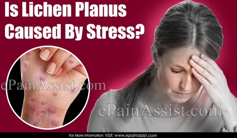 Is Lichen Planus Caused By Stress?