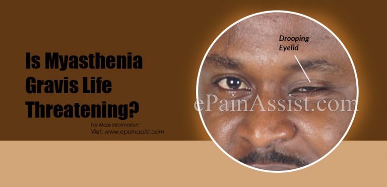 Is Myasthenia Gravis Life Threatening?