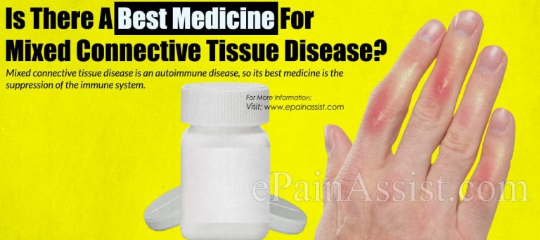 Is There A Best Medicine For Mixed Connective Tissue Disease?