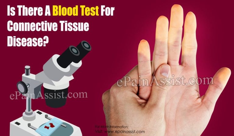 Is There A Blood Test For Connective Tissue Disease?