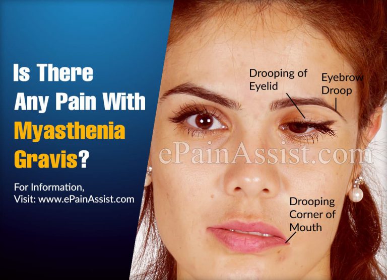 Is There Any Pain With Myasthenia Gravis?