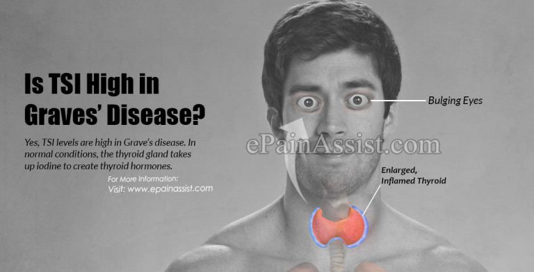 Is TSI High in Graves’ Disease?