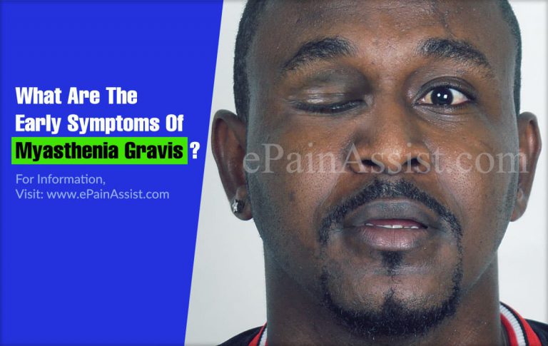 What Are The Early Symptoms Of Myasthenia Gravis?