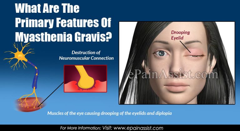 What Are The Primary Features Of Myasthenia Gravis?