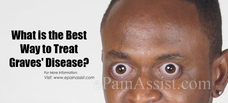 What is the Best Way to Treat Graves’ Disease?