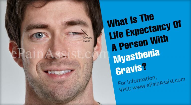 What Is The Life Expectancy Of A Person With Myasthenia Gravis?