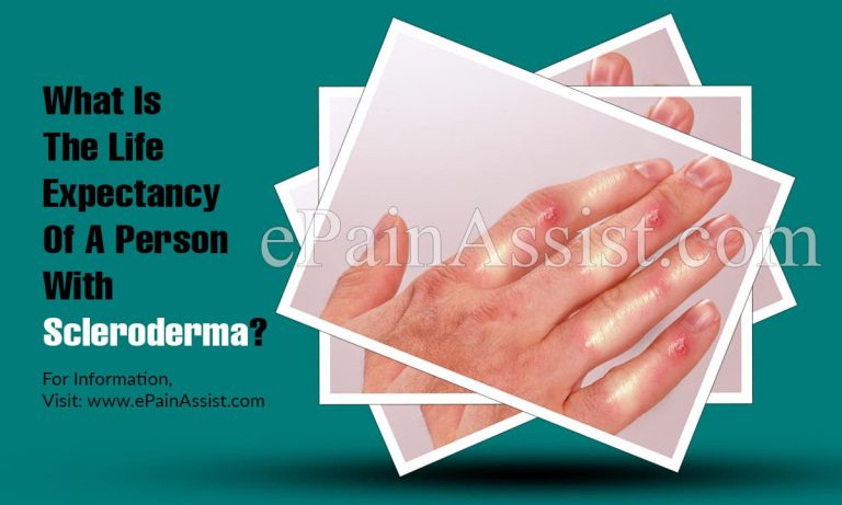 What Is The Life Expectancy Of A Person With Scleroderma?