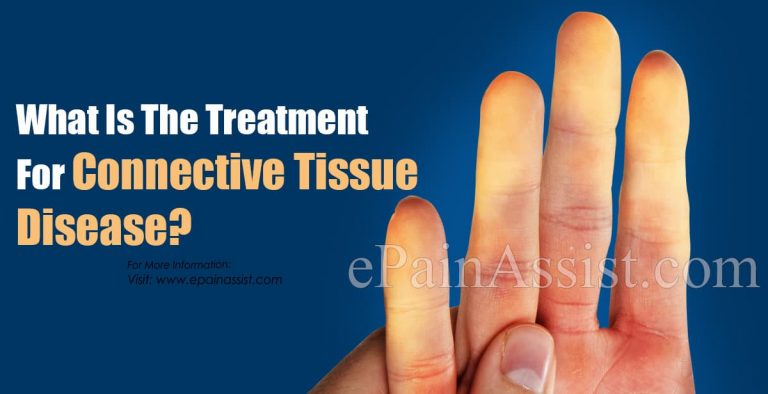 What Is The Treatment For Connective Tissue Disease?