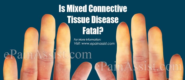 Is Mixed Connective Tissue Disease Fatal?